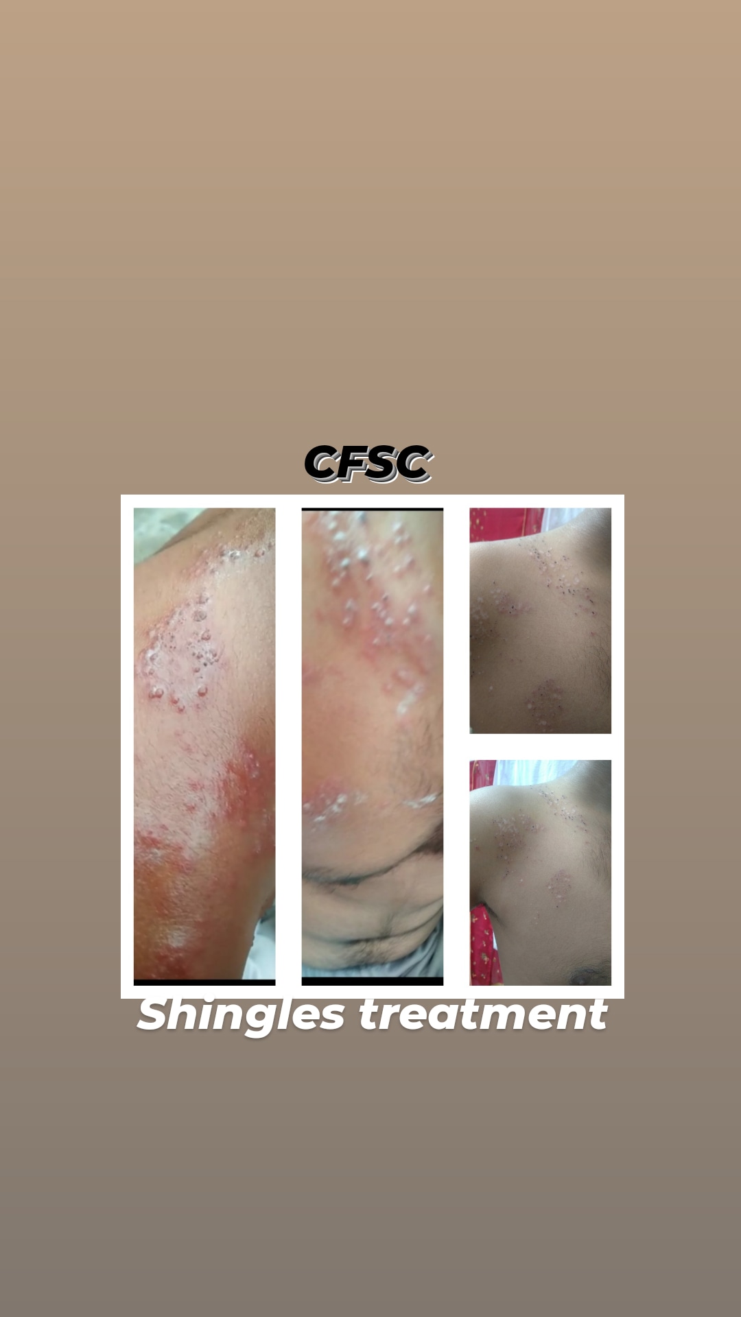 Before After Skin Treatment